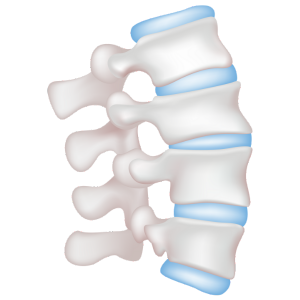 Fracturas por osteoporosis Fracturas por osteoporosis cuernavaca