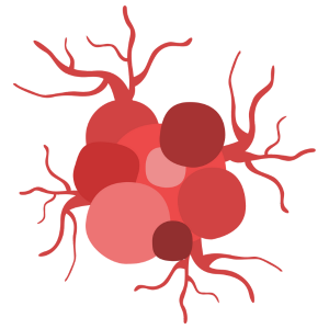 Tumor cerebral Tumor cerebral en cuernavaca
